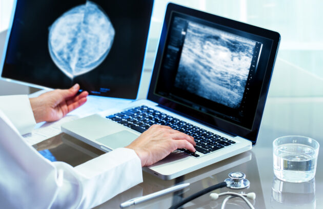 Understanding Mammography Referrals: Importance and Procedure